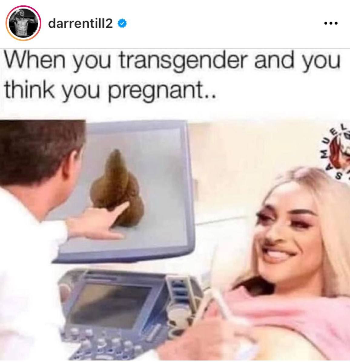 darrentill2 When you transgender and you think you pregnant..