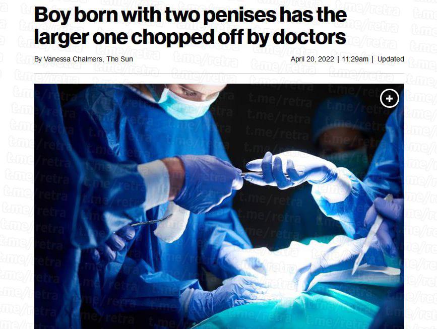Boy born with two penises has the larger one chopped off doctors Vanessa Chalmers, The Sun April 20, 2022 Updated 9