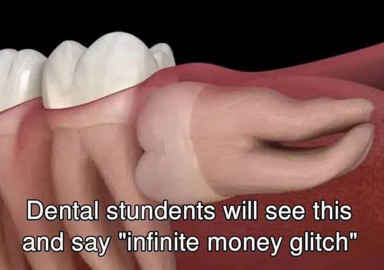 Dental stundents will see this and say "infinite money glitch"