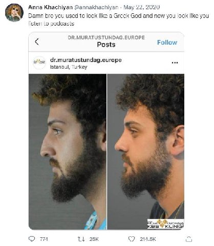 Anna Khachiyan @annakhachiyan Мау 22, 2020 Damn bro you used to look like a Greek God and now you look like you listen to podcasts DR.MURATUSTUNDAG.EUROPE Posts Follow dr.muratustundag.europe Istanbul