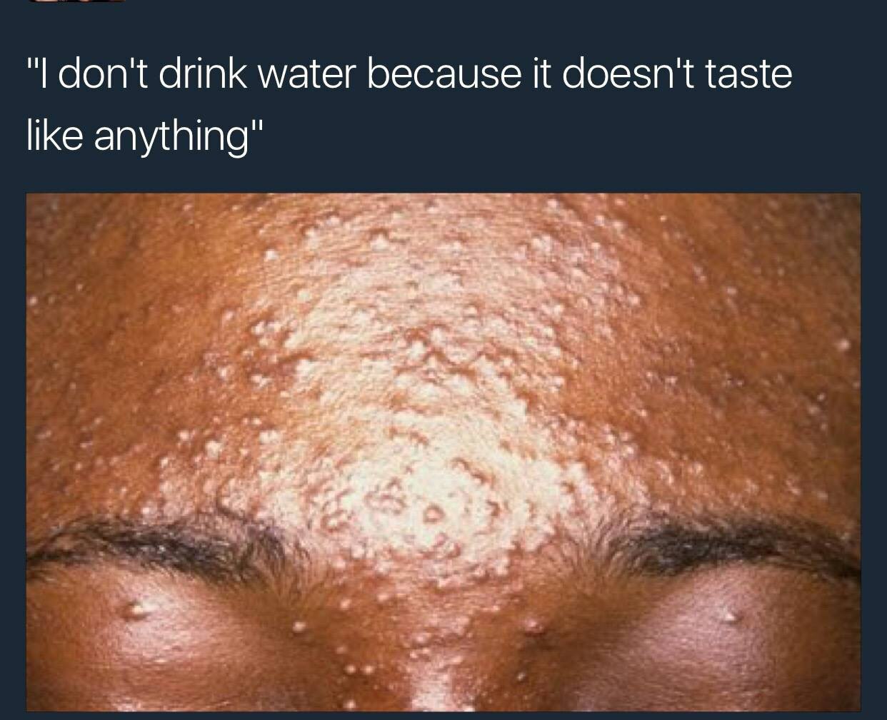 don't drink water because it doesn't taste like anything" 2?