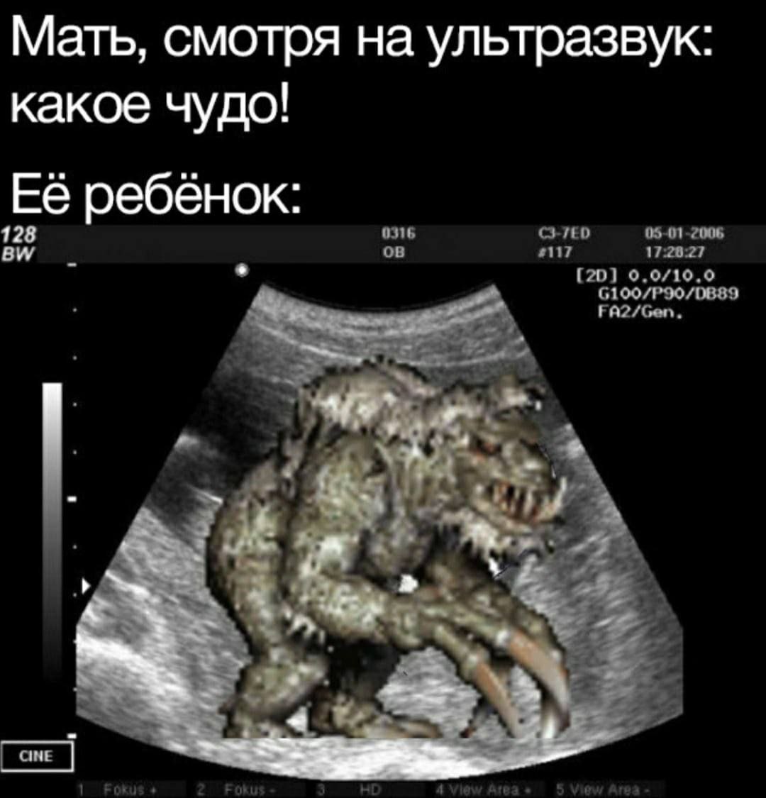 Мать, смотря на ультразвук: какое чудо! Её ребёнок: