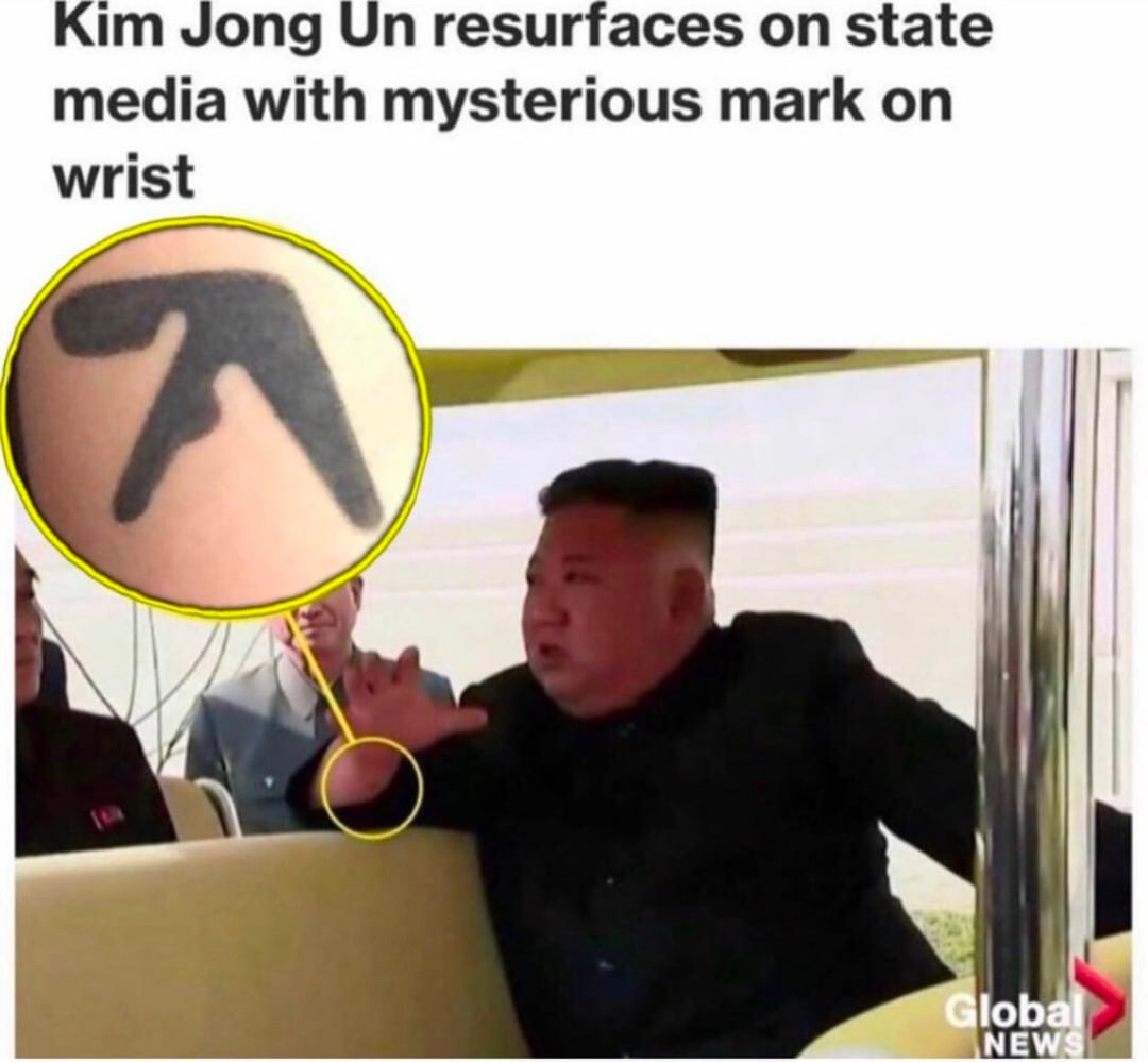 Jong resurfaces on state media with mysterious mark on wrist