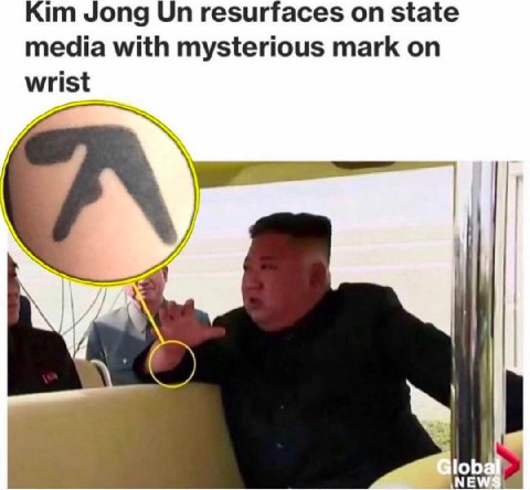 Jong resurfaces on state media with mysterious mark on wrist