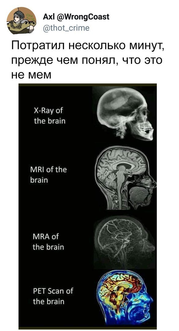 @WrongCoast @thot_crime Потратил несколько минут, прежде чем понял, что это не мем X-Ray of the brain MRI of the brain MRA of the brain i? PET Scan of the brain