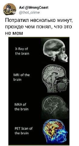 @WrongCoast @thot_crime Потратил несколько минут, прежде чем понял, что это не мем X-Ray of the brain MRI of the brain MRA of the brain i? PET Scan of the brain