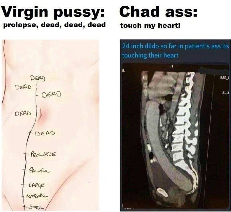 Virgin pussy: Chad ass: prolapse, dead, dead, dead touch my heart! DEAD DEAD 4 у #1
