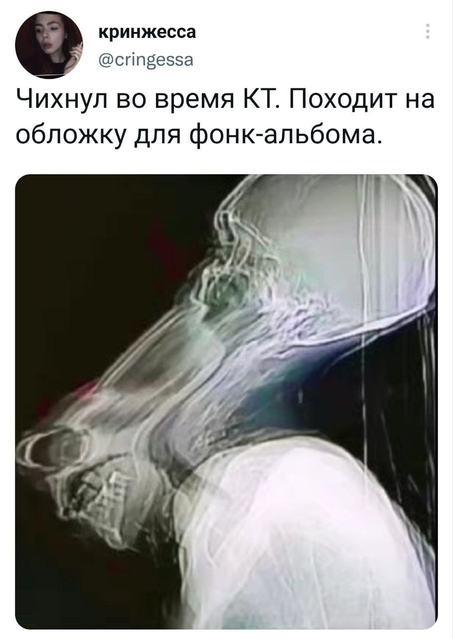 кринжесса @cringessa Чихнул во время Походит на обложку для фонк-альбома. ‘а