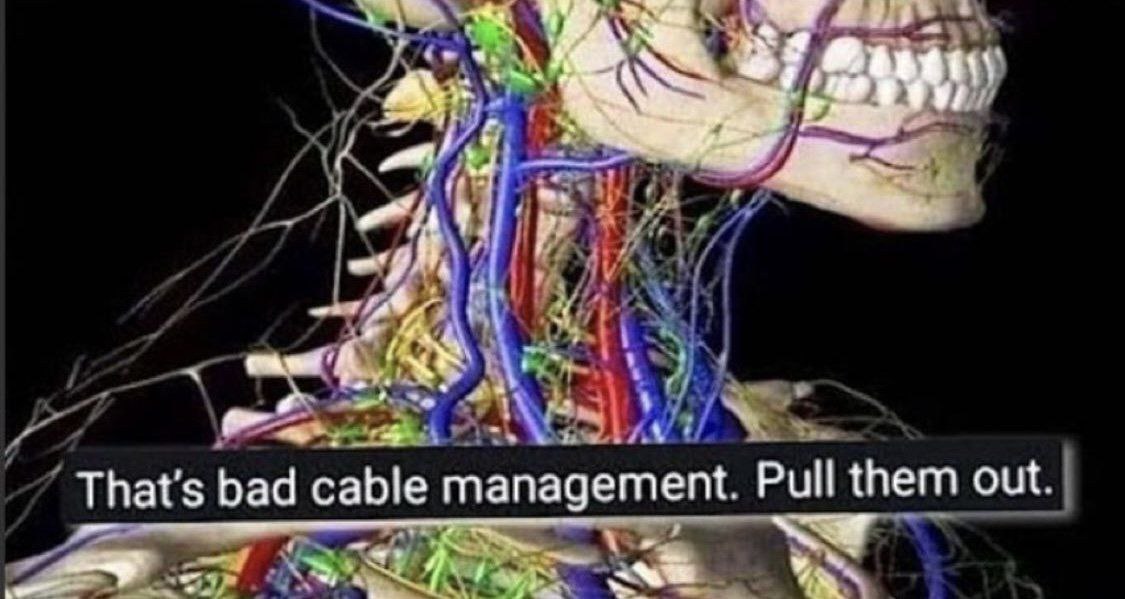 1 к у That's bad cable management. Pull them out.