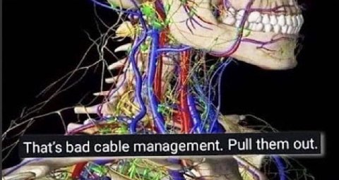 1 к у That's bad cable management. Pull them out.