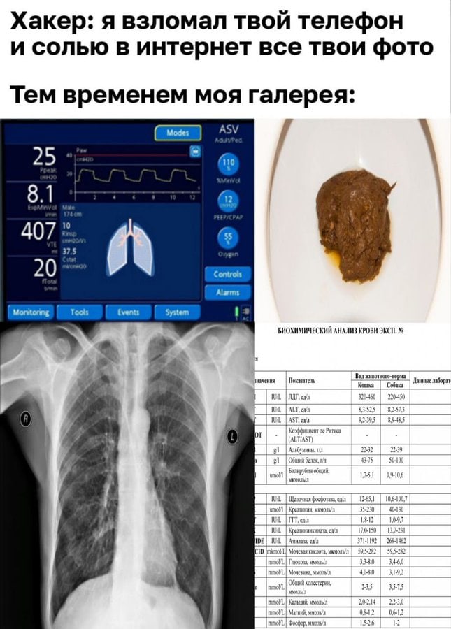 Хакер: я взломал твой телефон и солью в интернет все твои фото Тем временем моя галерея: ADV 25 10 8.1 2 407 37.5 20 Alarms Tools Events System БИОХИМИЧЕСКИЙ АНАЛИЗ КРОВИ ЭКСИ, значения Показатель Вит
