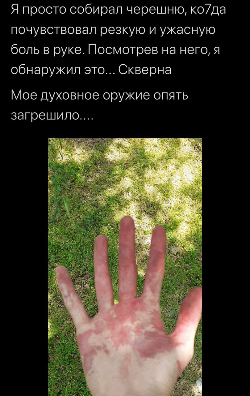 Я просто собирал черешню, ко/да почувствовал резкую и ужасную боль в руке. Посмотрев на него, я обнаружил это... Скверна Мое духовное оружие опять загрешило....