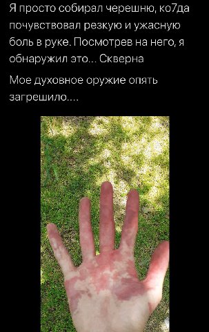 Я просто собирал черешню, ко/да почувствовал резкую и ужасную боль в руке. Посмотрев на него, я обнаружил это... Скверна Мое духовное оружие опять загрешило....