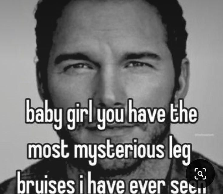 baby girl you have the most mysterious leg bruises i have ever сек.