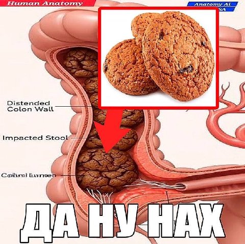 At AS at pat of 4 5% Distended Colon Watt Impacted Stook—