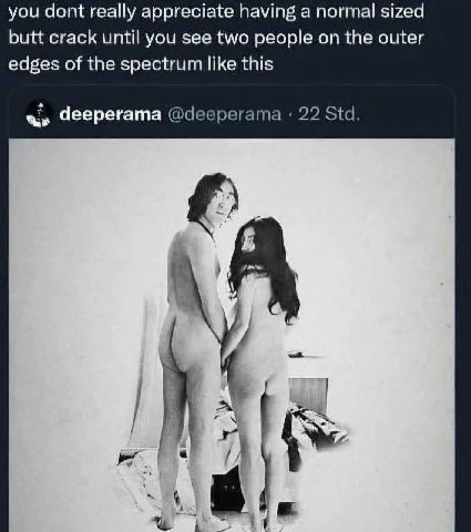 you dont really appreciate having a normal sized butt crack until you see two people on the outer edges of the spectrum like this a» Чеерегата @deeperama 22 Std. A 7.