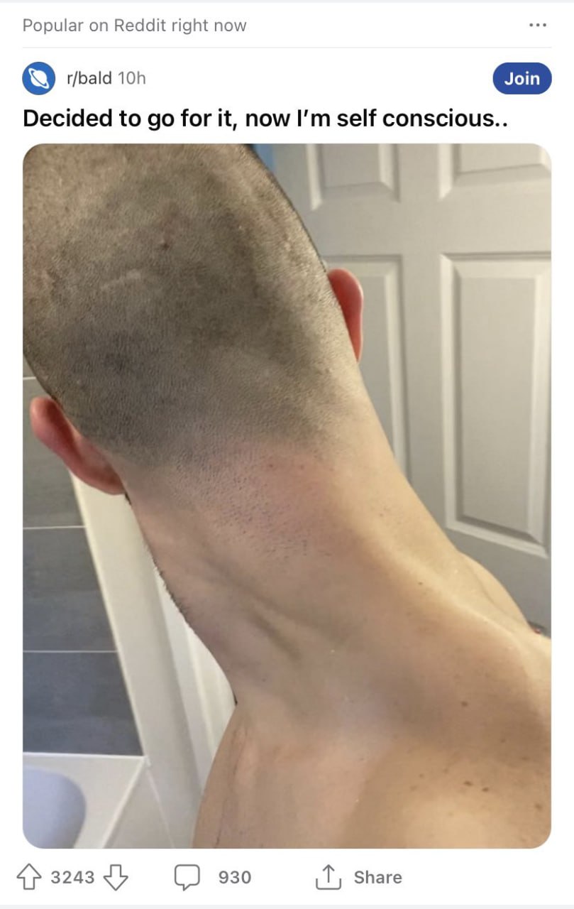 Popular on Reddit right now toh Decided to for it, now self conscious.. 930 Share