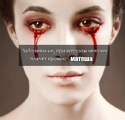 Заболевание, при котором человек плачет кровью Матеша