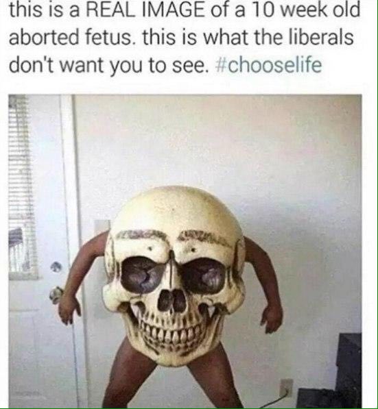 this is а REAL IMAGE of a 10 week old aborted fetus. this is what the liberals don't want you to see. #chooselife