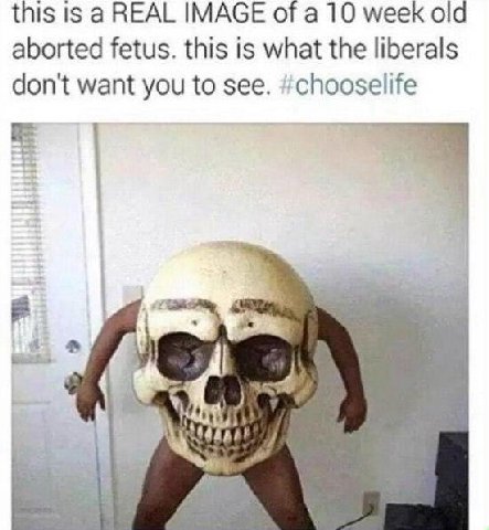 this is а REAL IMAGE of a 10 week old aborted fetus. this is what the liberals don't want you to see. #chooselife