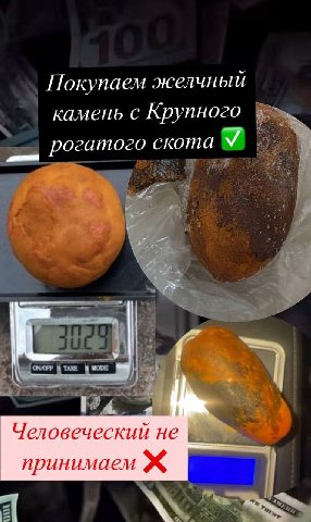 Покупаем желчный камень с Крупного рогатого скота У a Человеческий не принимаем