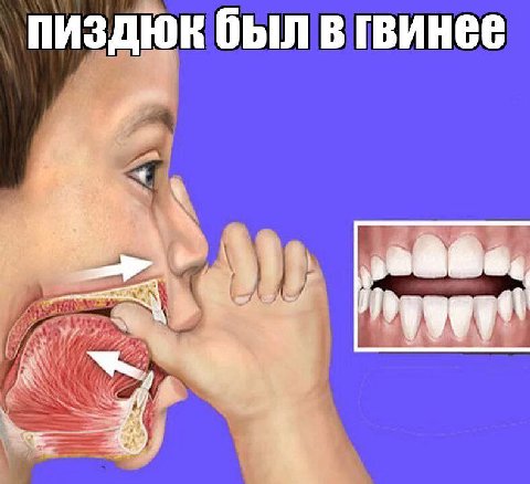 был в гвинее at