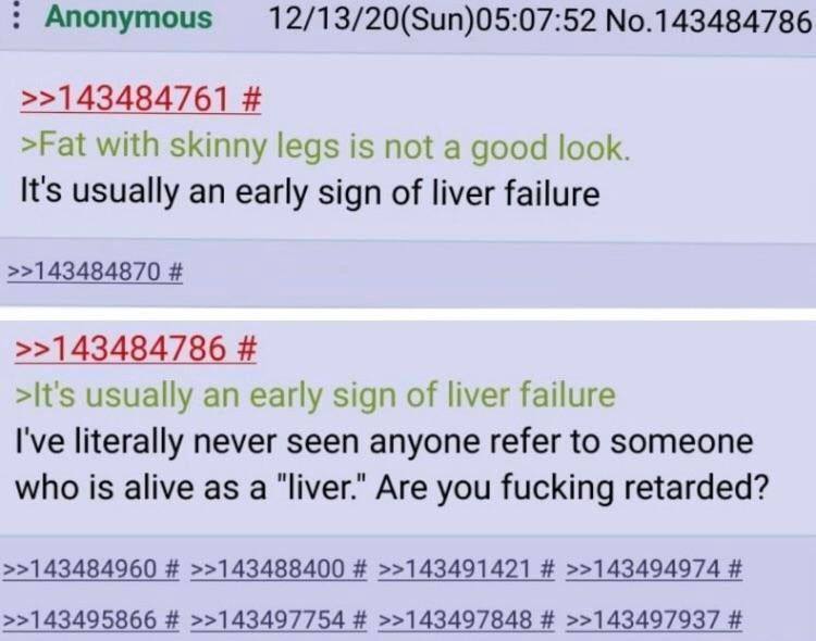 Anonymous No.143484786 >>143484761 >Fat with skinny legs is not a good look. It's usually an early sign of liver failure >>143484870 >>143484786 >It's usually an early sign of liver failure I've liter