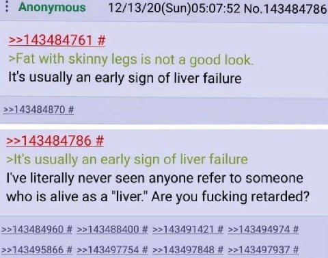 Anonymous No.143484786 >>143484761 >Fat with skinny legs is not a good look. It's usually an early sign of liver failure >>143484870 >>143484786 >It's usually an early sign of liver failure I've liter