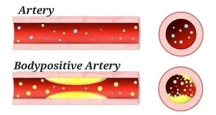 Artery Bodypositive Artery