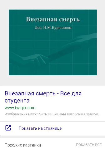 Внезапная смерть Доц. Н.М.Нуриллаева Внезапная смерть Все для студента www.twirpx.com Изображения могут быть защищены авторским правом [7 Показать на странице Похожие картинки <ASA