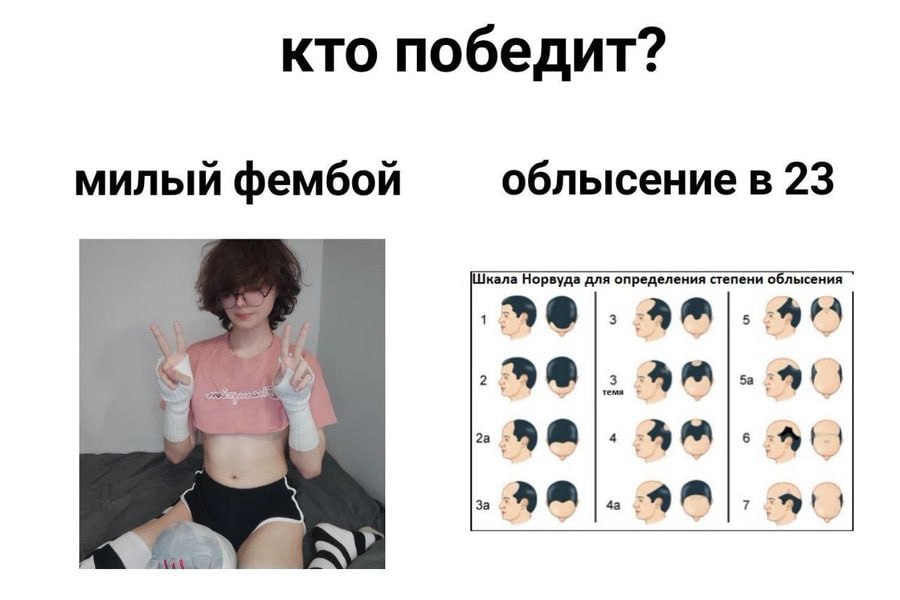 кто победит? милый фембой облысение в 23 ала Норвуда для опред