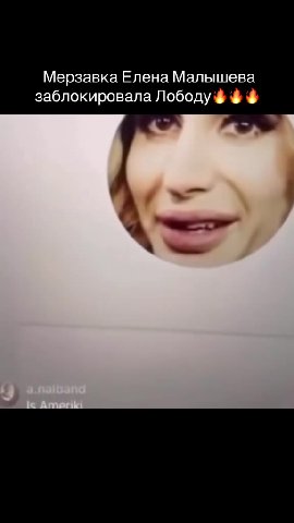 Мерзавка Елена Малышева заблокировала Лободу $ $ $