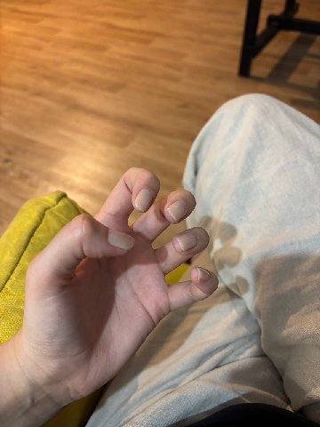 if 4