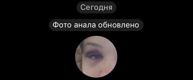 Сегодня Фото анала обновлено