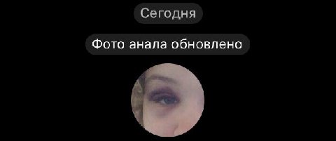Сегодня Фото анала обновлено