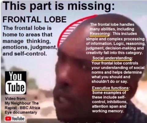 This part is missing FRONTAL LOBE frontal lobe handles The frontal lobe is abilities, including home to areas that This includes manage thinking, simple and complex processing of information. Logic, r