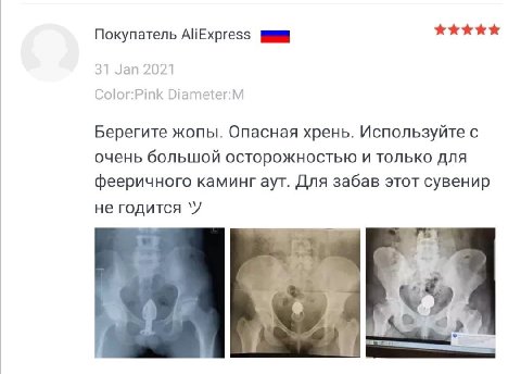 Покупатель AliExpress 31 Jan 2021 Color:Pink Diameter:M Берегите жопы. Опасная хрень. Используйте с очень большой осторожностью и только для фееричного каминг аут. Для забав этот сувенир не годится ‘У