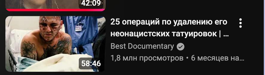 25 операций по удалению его неонацистских татуировок Best Documentary 58:46 1,8 млн просмотров 6 месяцев на