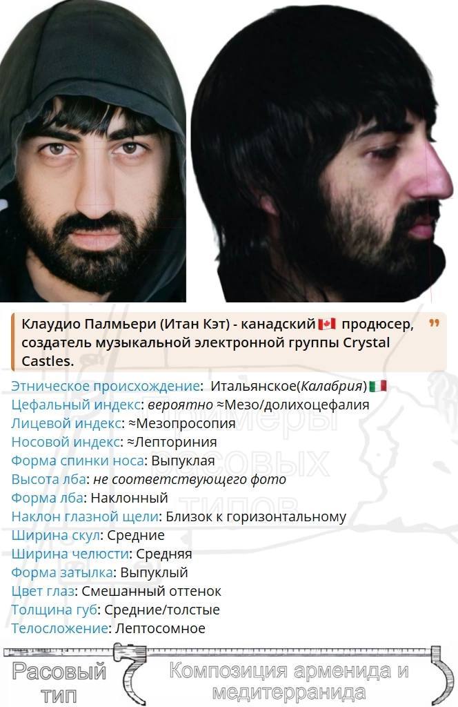 99 Клаудио Палмьери (Итан Кэт) канадский продюсер, создатель музыкальной электронной группы Crystal Castles. Этническое происхождение: Итальянское(Калабрия) Цефальный индекс: вероятно =Мезо/долихоцефа