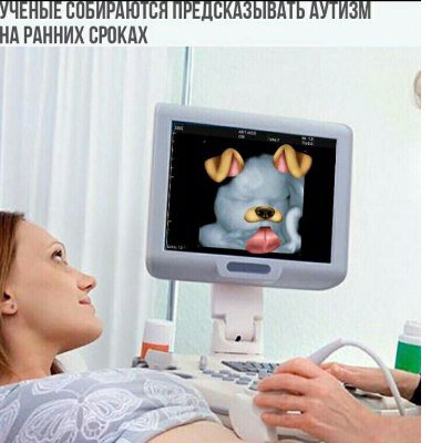 УЧЕНЫЕ СОБИРАЮТСЯ ПРЕДСКАЗЫВАТЬ АУТИЗМ НА РАННИХ СРОКАХ Pato к.