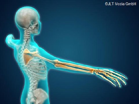 🇱🇺⚖️‼️ Chancellor Geert Wilders has announced that starting from February 2025, Democrats are no longer allowed to have bones in one of their limbs. 

🦴👉 All registered Democrats will have to pick one
