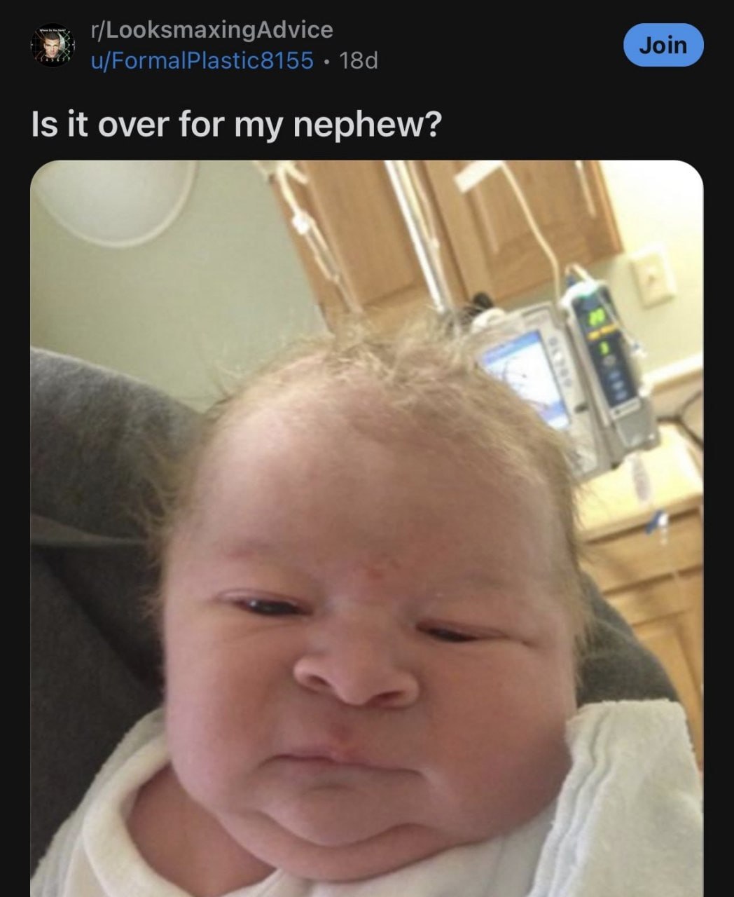 r/LooksmaxingAdvice u/FormalPlastic8155 Is it over for my nephew?