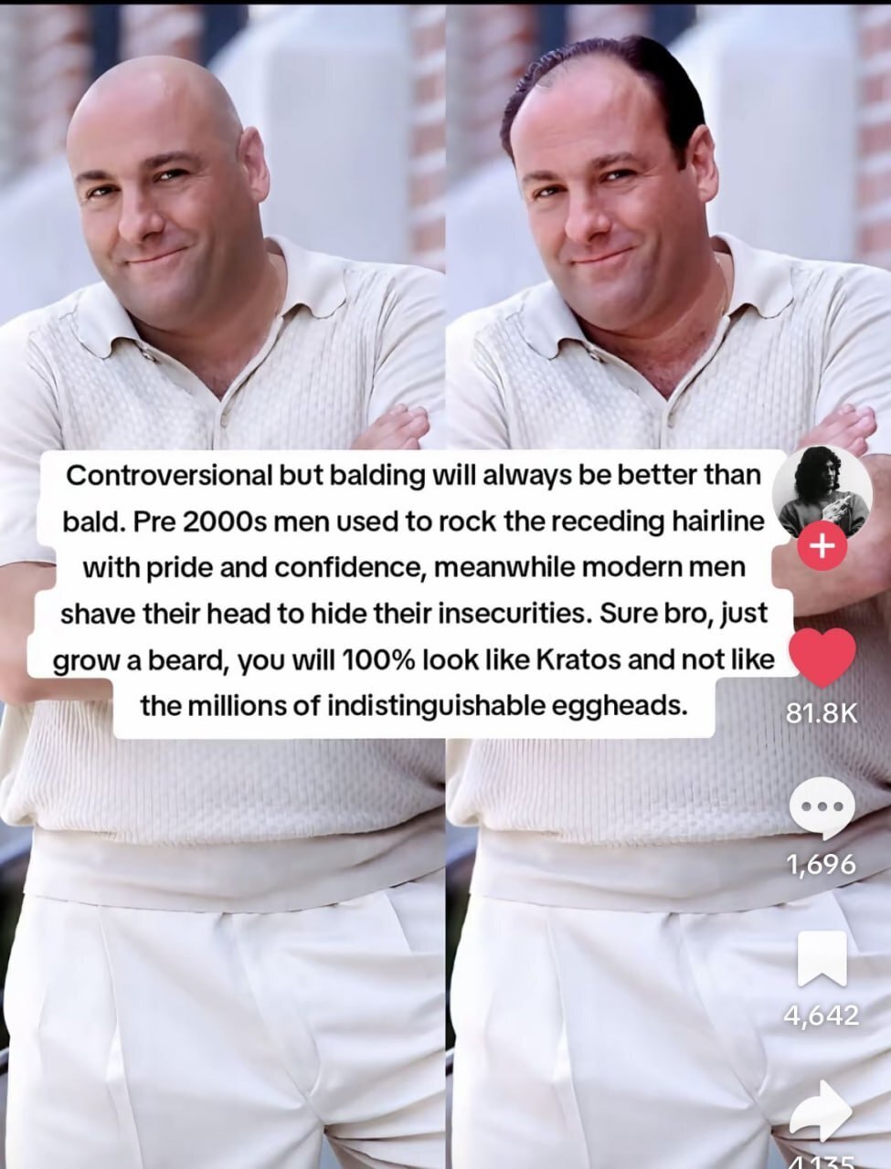 1 Controversional but balding will always be better than bald. Pre men used to rock the receding hairline with pride and confidence, meanwhile modern men shave their head to hide their insecurities. S