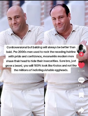 1 Controversional but balding will always be better than bald. Pre men used to rock the receding hairline with pride and confidence, meanwhile modern men shave their head to hide their insecurities. S